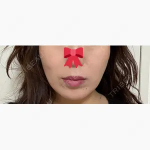 APスキンクリニック銀座口コミ