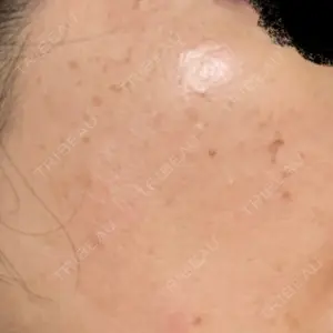 ルラ美容クリニック 福岡本院口コミ