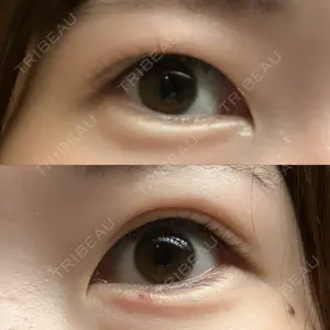 フィラークリニック 新宿院口コミ