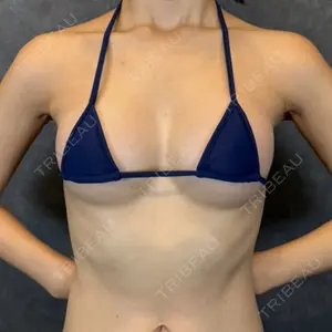 AVAN TOKYO 銀座脂肪吸引 クリニック口コミ