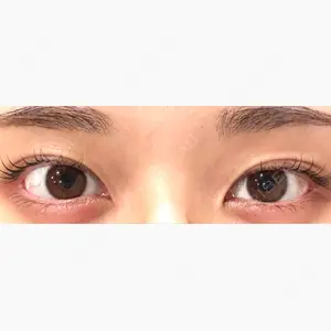 リッツ美容外科 大阪院口コミ