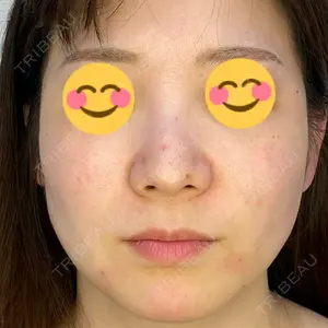 APスキンクリニック銀座口コミ