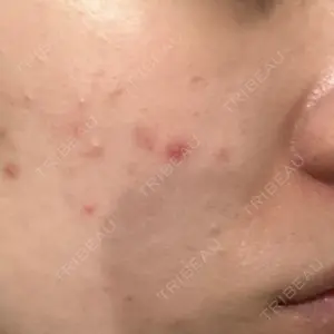 Belle Via Skin Clinic口コミ