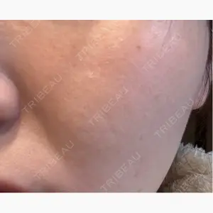 銀座みゆき通り美容外科 大阪梅田院口コミ