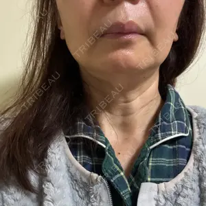 BAO CLINIC 神戸院口コミ