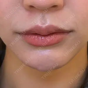 AI Beauty Clinic （エーアイ美容クリニック）口コミ