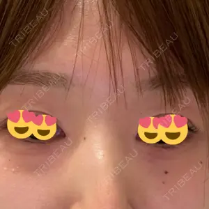 HAAB×DREAM BEAUTY CLINIC 東京本院口コミ