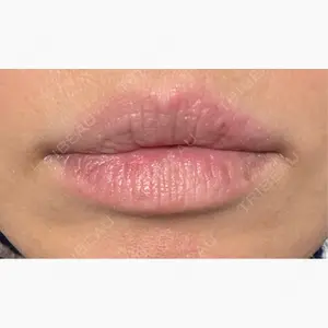 NEXUS CLINIC口コミ