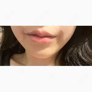 麻布十番クレールデンタルクリニック口コミ