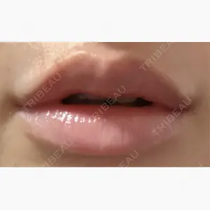 ルラ美容クリニック 新宿院口コミ