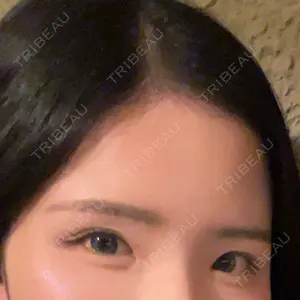 HAAB×DREAM BEAUTY CLINIC 大阪梅田院口コミ