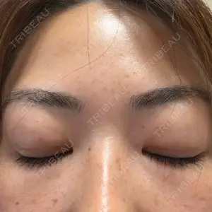 TCB東京中央美容外科 船橋院口コミ