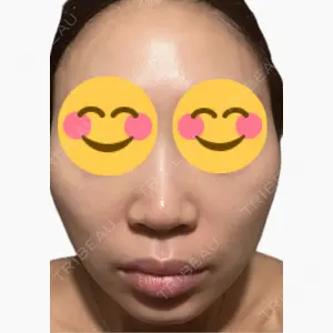 美容皮膚科エルムクリニック 麻布院口コミ