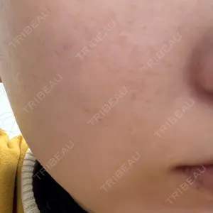 銀座みゆき通り美容外科 大阪梅田院口コミ