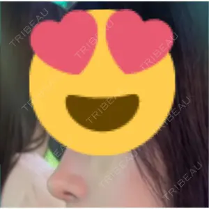 id（アイディ）美容外科口コミ