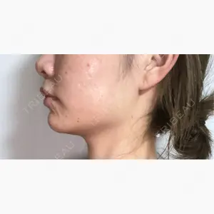 TCB東京中央美容外科 那覇院口コミ