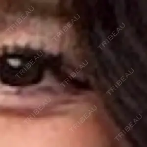 AB美容クリニック 新宿院口コミ