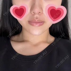 HAAB BEAUTY CLINIC 名古屋院口コミ