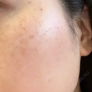 東京美容外科 梅田院口コミ