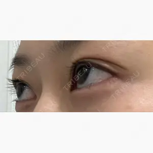 フィラークリニック 新宿院口コミ