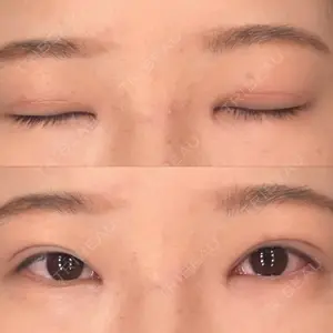 銀座みゆき通り美容外科 大阪梅田院口コミ