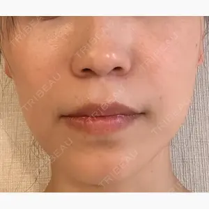 TCB東京中央美容外科 名古屋栄院口コミ