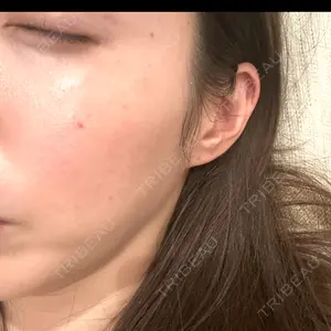 ルラ美容クリニック 千葉院 / ルラスキンクリニック 千葉院口コミ