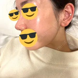 CHARIS BEAUTY CLINIC口コミ