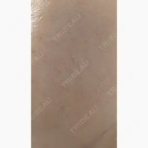 MIO CLINIC 梅田院口コミ