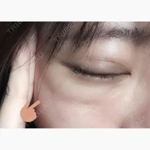 PRO CLINIC プロクリニック 銀座院口コミ