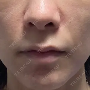 ルラ美容クリニック 渋谷本院口コミ