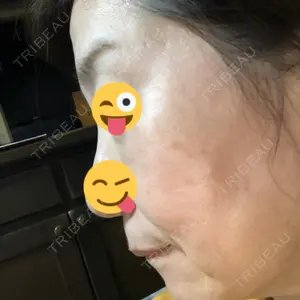 MIO CLINIC 梅田院口コミ