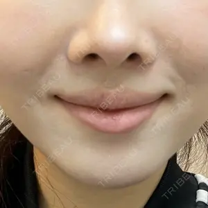 AYANAフィラーズクリニック 武蔵小杉院口コミ