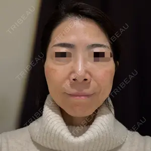 銀座みゆき通り美容外科 大阪梅田院口コミ