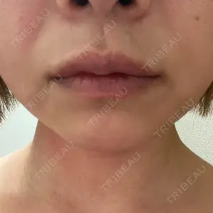 HAAB BEAUTY CLINIC 南青山本院（新院）口コミ