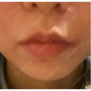 メディカルアルファクリニック口コミ