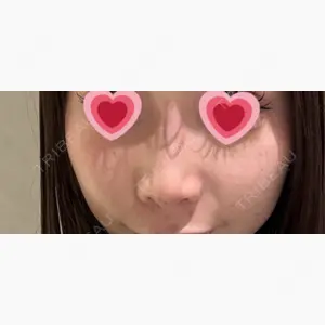 Tokyo Tensei Clinic 大阪梅田院口コミ