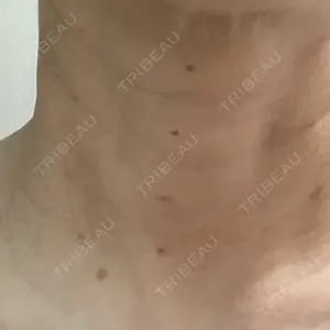 ゆきスキンクリニック 東池袋口コミ