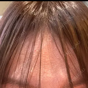 TCB東京中央美容外科 神戸院口コミ