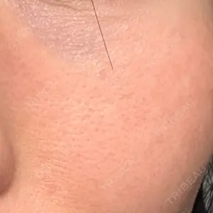 湘南美容クリニック 広島院口コミ