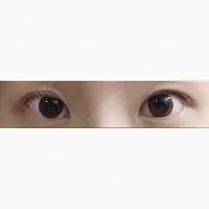MIYAフェイスクリニック口コミ
