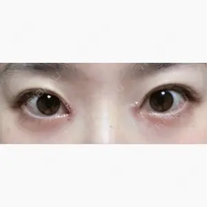 新宿美容外科ネビュラクリニック口コミ