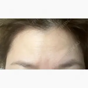 TCB東京中央美容外科 北千住院口コミ