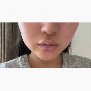 DMTC CLINIC 渋谷院口コミ