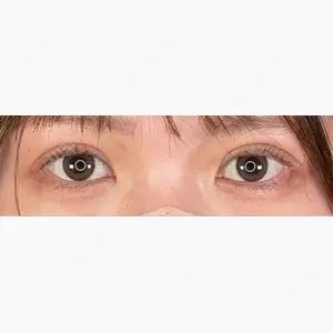 アリエル美容クリニック 郡山院口コミ