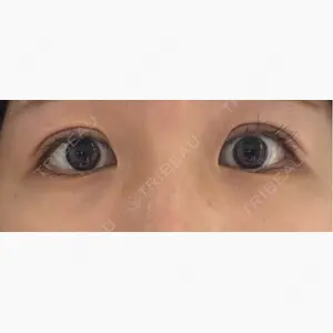 サラ美容外科口コミ