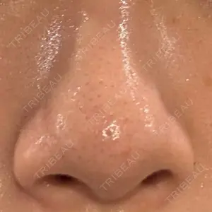 東京素肌クリニック 新宿院口コミ