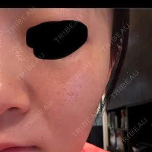 Chloe Cheongdam Clinic （クロエチョンダムクリニック）口コミ