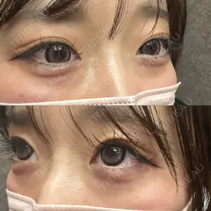 吉祥寺アイビークリニック口コミ