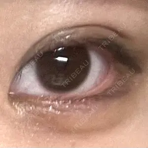 ルラ美容クリニック 札幌本院口コミ